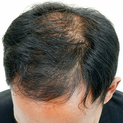 before-img